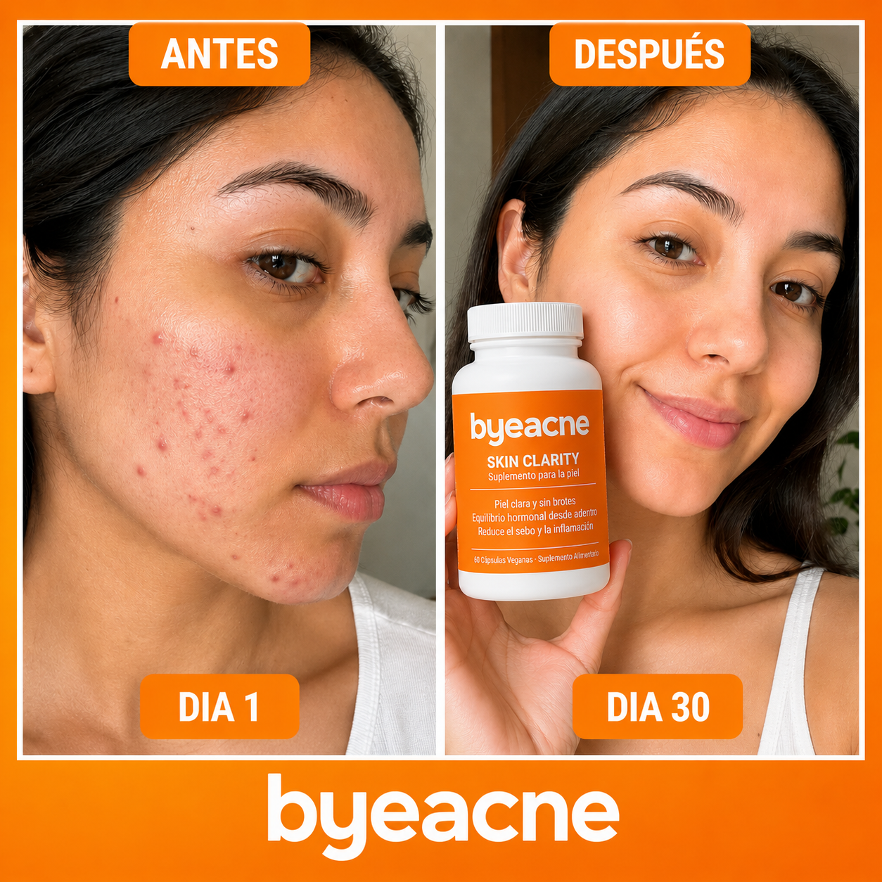 Byeacne® - Volvé a mostrar tu piel sin esconderte